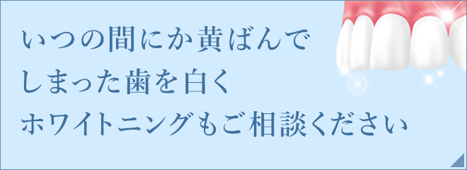 いつの間にか黄ばんでしまった歯を白くホワイトニングもご相談ください